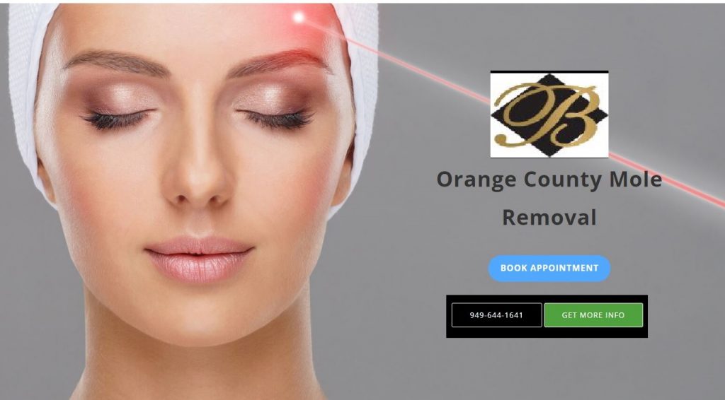 Orange County Mole Removal Services Top Mole Removal Experts SantiHealth